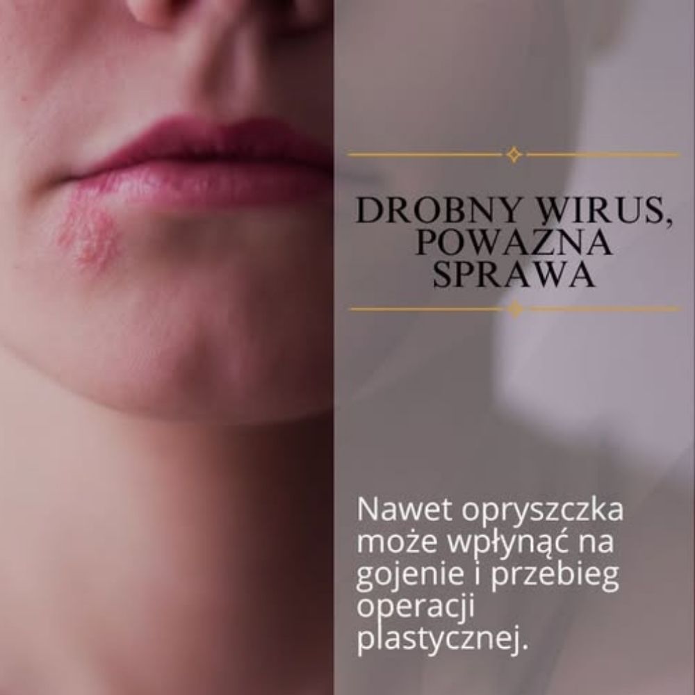 Zwykła "opryszczka" i jej wpływ na gojenie się ran po operacjach